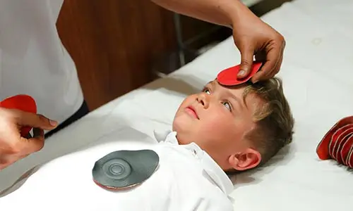 Aplicação dos imãs